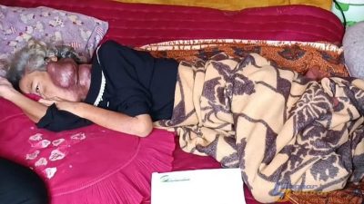 Mantan Walkot Banjar Herman Sutrisno Kunjungi Warga Penderita Tumor, Serukan Kepedulian dan Aksi Nyata