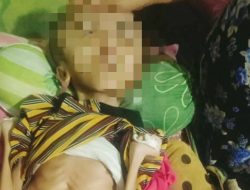 Viral Lagi! Remaja Sukabumi Hidrosefalus Gagal Lanjutkan Perawatan, Orang Tua Terlilit Hutang